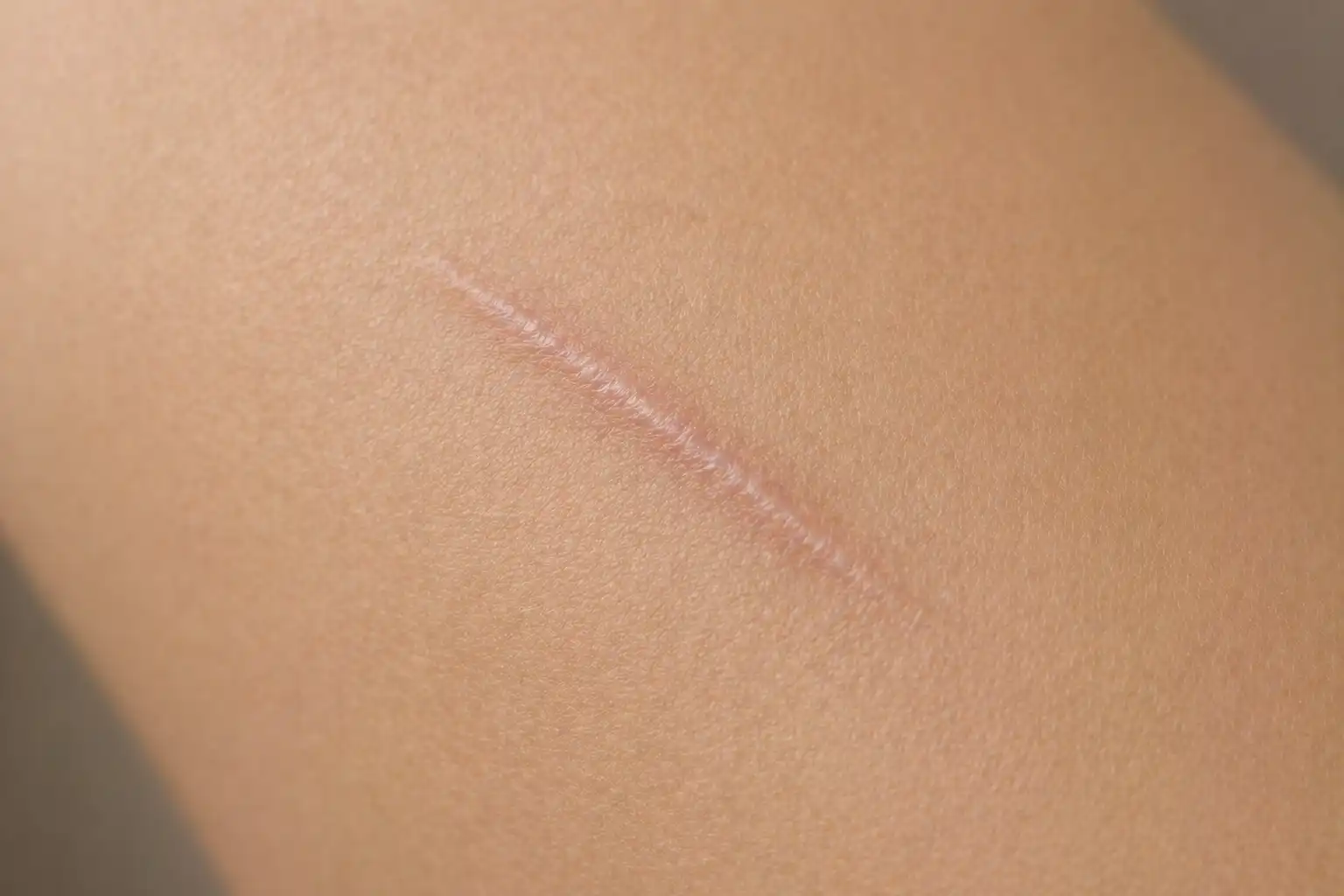 sen o bliźnie symbolika zagojonej rany śladu po przeszłości i dojrzałej pamięci o doświadczeniu